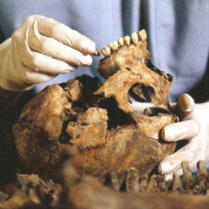 Odontología Forense